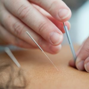 Synerqi | Acupuncture in Vernon, BC